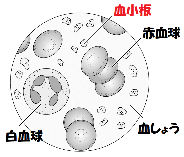 血小板